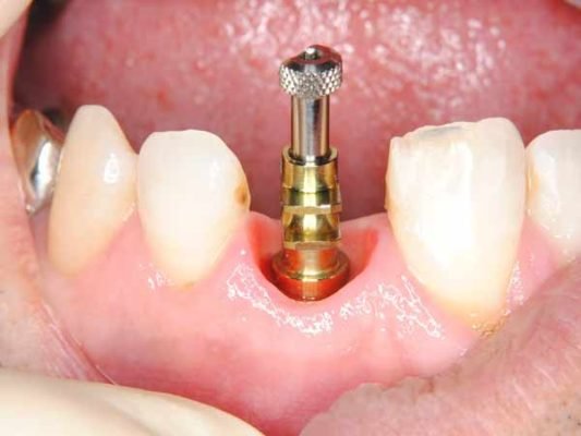 Dr. Durbac - Stomatologie generala, implantologie, estetica dentara